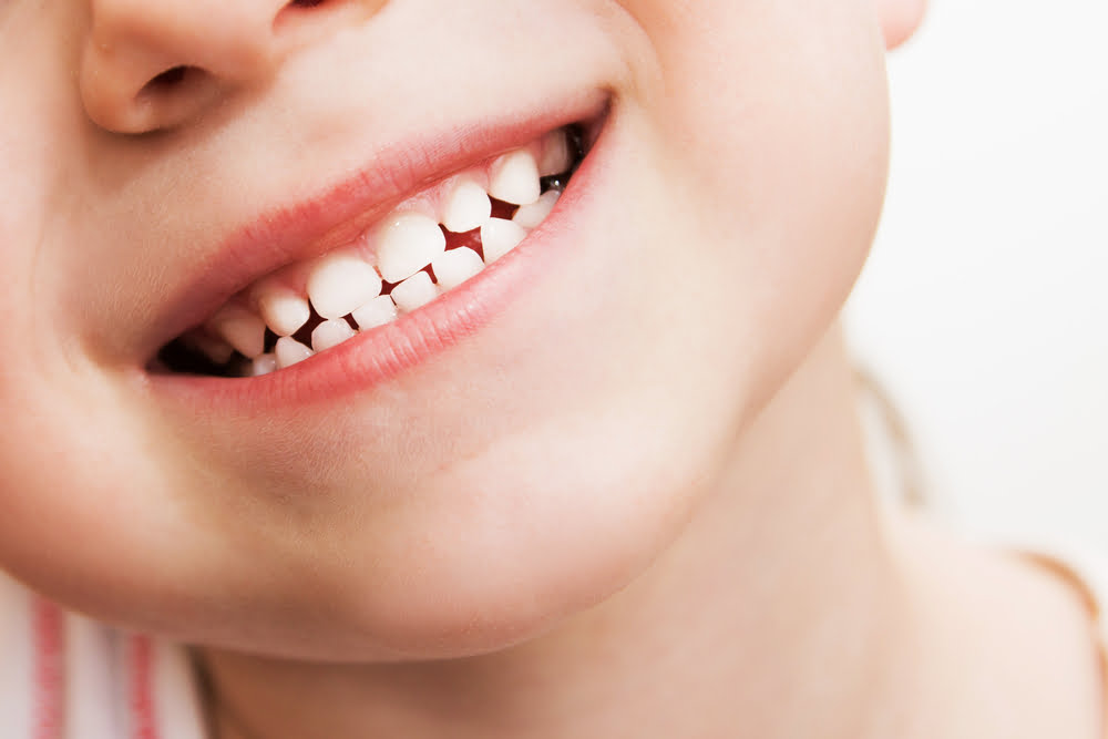 children-teeth-dental-care