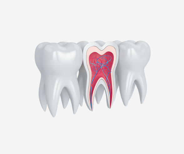 root-canal-inside-illustration