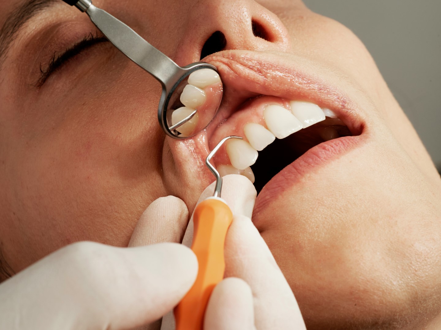 closed-up-of-dentist-checking-a-men's-teeth