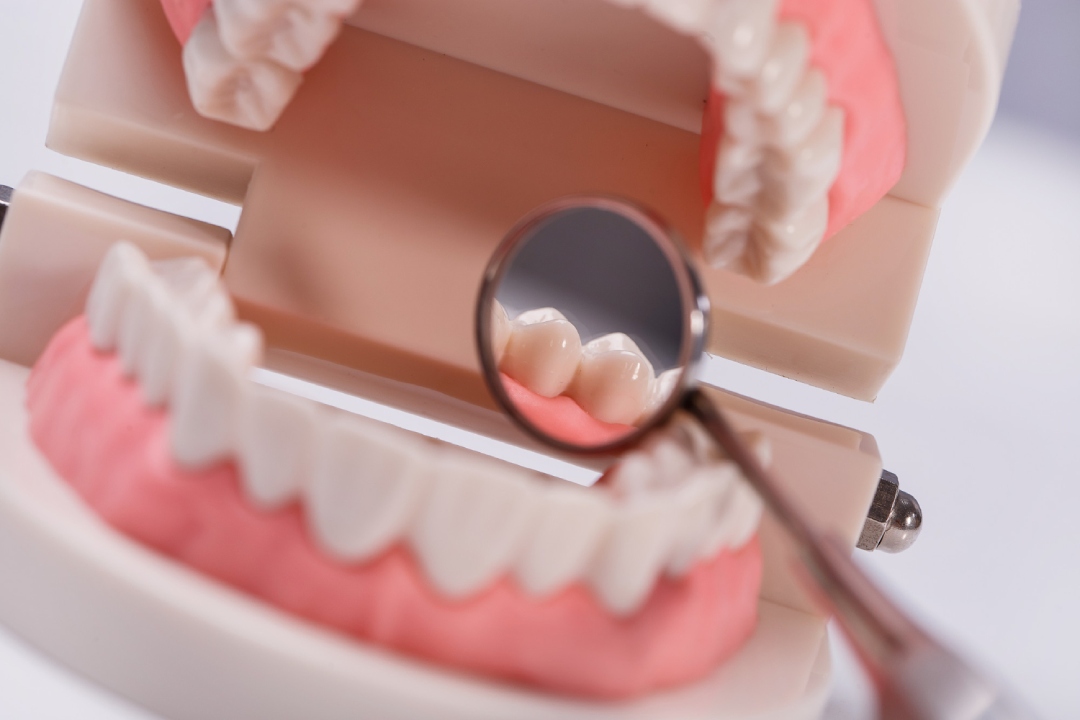 teeth-whitening-treatment-performed-on-artificial-teeth
